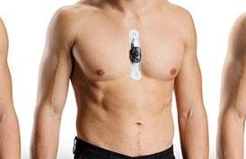 Patient wearing a Holter monitor for continuous ECG recording and heart rhythm assessment.